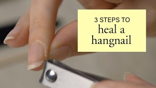 3 Steps to Heal a Hangnail [upl. by Tiram757]