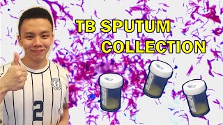 How to do a proper sputum collection [upl. by Areik926]