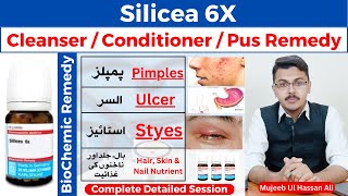 Silicea 6x Homeopathic Medicine Benefits  Silicea Homeopathic Medicine  Silicea [upl. by Gasparo]