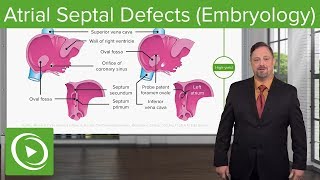 Atrial Septal Defects – Embryology  Lecturio [upl. by Glennis790]