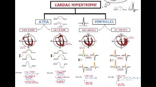 Electrocardiogram  Atrial amp Ventricular Hypertrophy [upl. by Ykciv44]