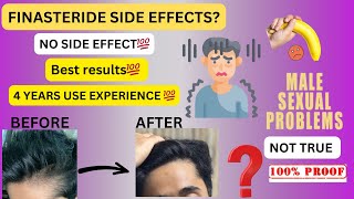 FINASTERIDE No SIDE EFFECTS  RESULTS and experience [upl. by Iny]