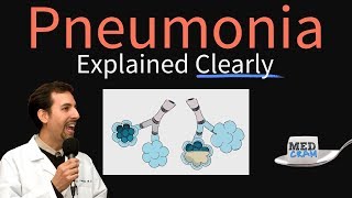 Pneumonia Explained Clearly by MedCramcom [upl. by Hoon]