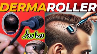 Microneedling  Derma Rolling for Hair Regrowth  Derma Roller Side Effects [upl. by Kcarb]