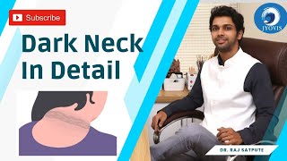 How to Get Rid of Dark Neck Naturally amp Permanently  Dark Neck In Detail  Neck Whitening Tips [upl. by Themis]