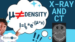 Xray Attenuation Coefficients  Xray Attenuation Calculator  A level Medical Physics [upl. by Notyal]