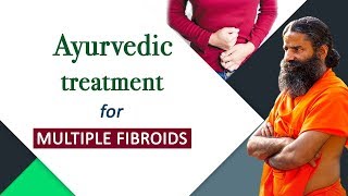 Ayurvedic Treatment for Multiple Fibroids  Swami Ramdev [upl. by Aicined465]