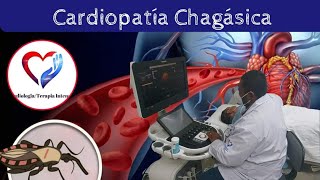 CardiopatÍa chagásica [upl. by Voltz955]