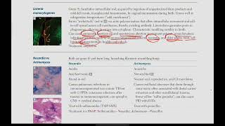 Listeria Monocytogenes Nocardia vs Actinomyces  Microbiology  13  First Aid USMLE in UrduHindi [upl. by Nosretep]