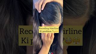 Receding hairline ki problem 🙁 naturally solution haircare hairline hairstyle haircare tip [upl. by Domella555]