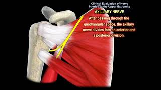 NERVE INJURY IN THE UPPER EXTREMITY Everything You Need To Know  Dr Nabil Ebraheim [upl. by Lanoil]