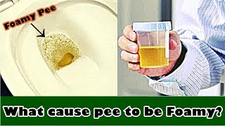 Frothy Urine – What cause pee to be Foamy [upl. by Havener]