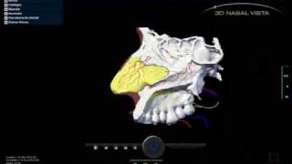 3D NASAL VISTA  Demo 03 [upl. by Kieger579]