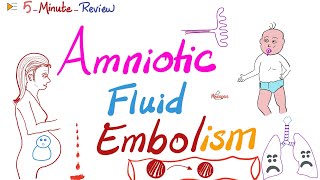 Amniotic Fluid Embolism  ObGyn Pathology Lectures  5MinuteReview Series [upl. by Inaluahek]