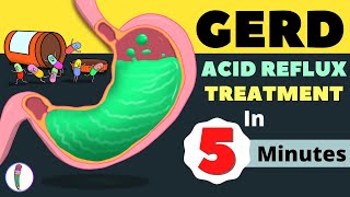 GERD Treatment  Acid Reflux Treatment  Heartburn Treatment  All You Need to Know [upl. by Irb]