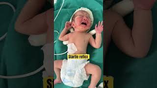 Newborn reflex  newborn assessment  primitive reflexes startle reflex youtubeshortsviralvideo [upl. by Laemsi803]