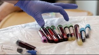 Cancer blood test great step towards early detection of disease  ITV News [upl. by Ytirev244]