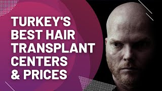 Turkeys Best Hair Transplant Centers amp Prices [upl. by Anstice]