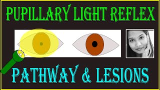 Pupillary Light Reflex – Pathway amp Lesions  Neuro ophthalmology [upl. by Ailliw788]