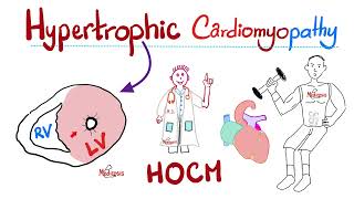 Hypertrophic Cardiomyopathy HOCM  Cardiology Series [upl. by Aicerg688]