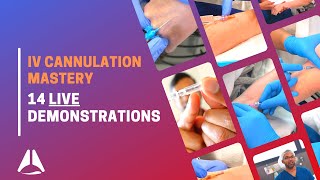 Intravenous IV cannulation compilation with demonstration of 14 procedures [upl. by Anestassia815]