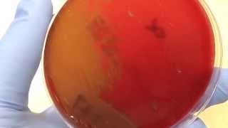 Microbiology  Hemolysis [upl. by Georas]