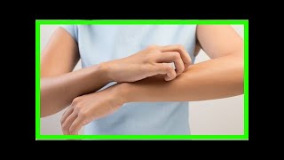 Causes of tingling skin is and how you can cure it [upl. by Matthews786]