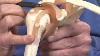 Shoulder Impingement  Dr Richard Hawkins [upl. by Wagoner90]