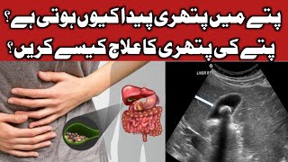 Gallstone symptoms and treatment in urdu  Dr Saif Ur Rehman [upl. by Skees364]