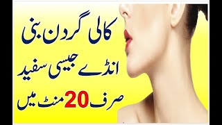 Neck Whitening Home Remedies  Neck Fairness Tips  Kali Gardan Ko Gora Karne Ka Tarika [upl. by Janean]