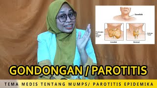 GONDONGAN  PAROTITIS EPIDEMIKA MUMPS [upl. by Herrod]