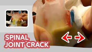 Spinal Joint Crack  Back Cracking SOUND Explained [upl. by Aalst]