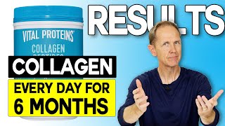 Vital Proteins Collagen Peptides  Results [upl. by Ylaek]