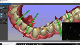 CS 3600  Identifying Fixing and Preventing Stitching Errors [upl. by Mooney999]