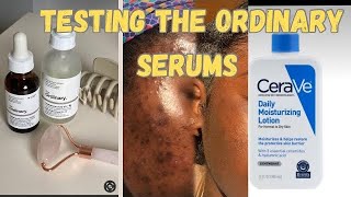 TRYING THE ORDINARY SERUMS ON ACNE PRONE SKIN SKIN CARE NIACINAMIDE [upl. by Cope]