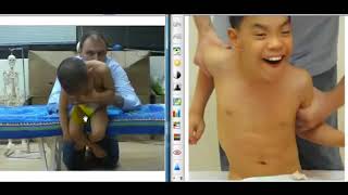 ABR Facts Case Study 9 Jared athetoid cerebral palsy [upl. by Srednas]