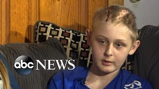 Miraculous recovery for 13yearold declared brain dead [upl. by Anifled715]