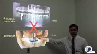 Radiografia Panorâmica x Tomografia  Radiodoc [upl. by Gizela]