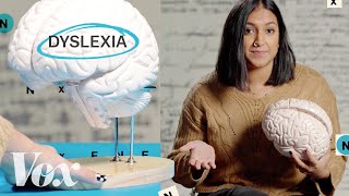 Why the dyslexic brain is misunderstood [upl. by Rebma]