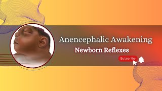 Exploring Reflexes in Babies with Anencephaly [upl. by Imre543]