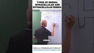 Types of edema Intracellular and extracellular edema [upl. by Arzed]