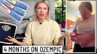 This is What Ozempic Does to Your Body After 4 Months SUPER HONEST [upl. by Arette]