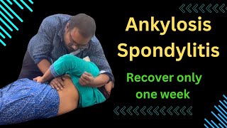 Ankylosis Spondylitis Recover Only One Week ankylosing spondylitis symptoms treating ankylosing [upl. by Boru]