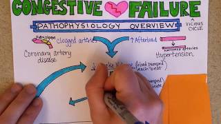 Congestive Heart Failure Pathophysiology [upl. by Nomis]